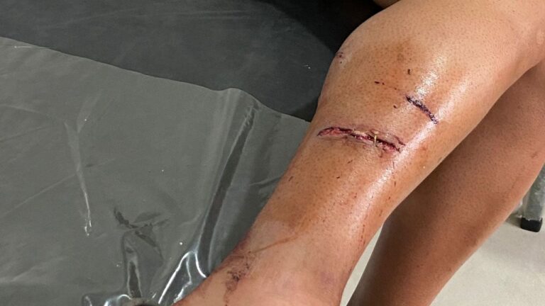 Una turista fue atacada por un dogo en Icho Cruz