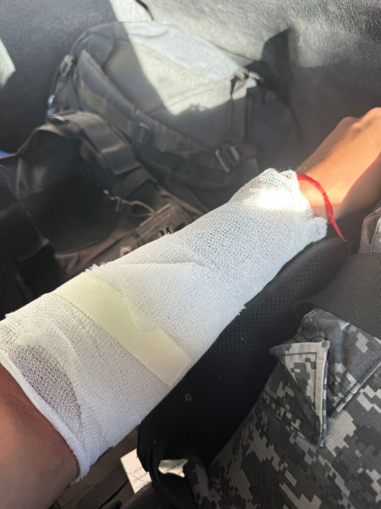Golpeó a su madre y arrojó agua hirviendo a los policías que fueron a detenerlo