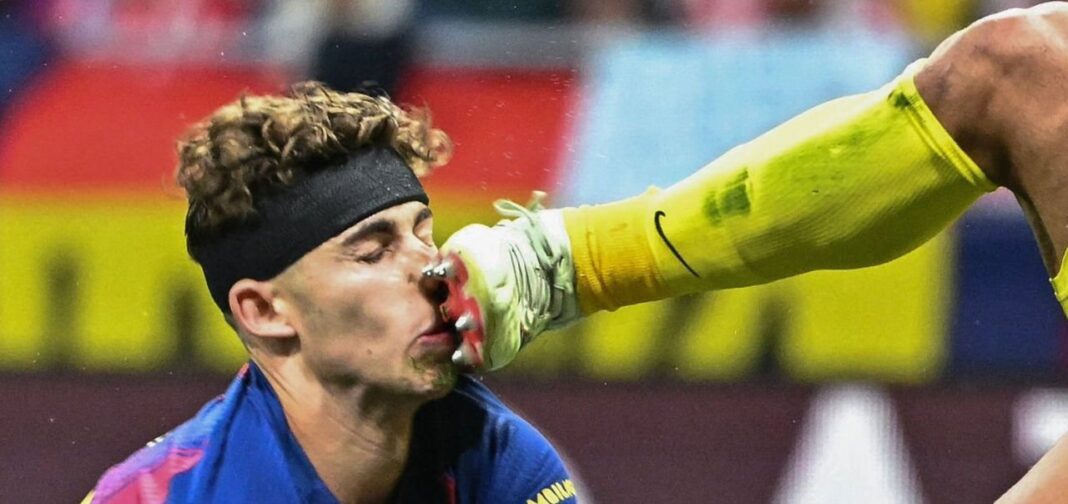 Juan Musso, arquero del Atlético de Madrid, durante el partido de Champions League.